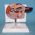 Human Natural Pancreas Anatomy Model for Medical Teaching (R130104)